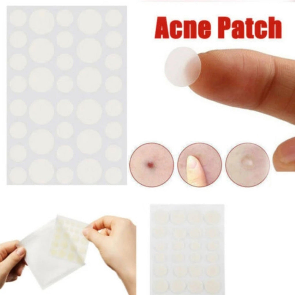 Hydro-Repair Pimple Patches (100+ in total)