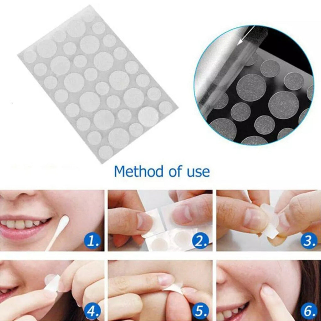 Hydro-Repair Pimple Patches (100+ in total)